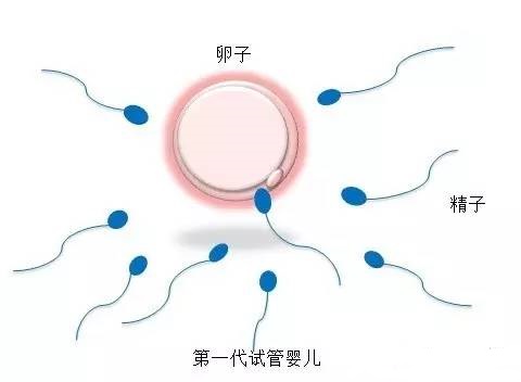有偿同志供卵代孕怎么预约